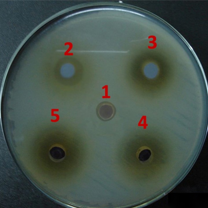 Salmonella Typhi laboratory assay
